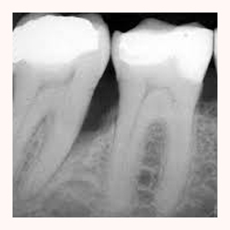 Vidar Dental X-Ray Scanning Solutions in Oxford UK